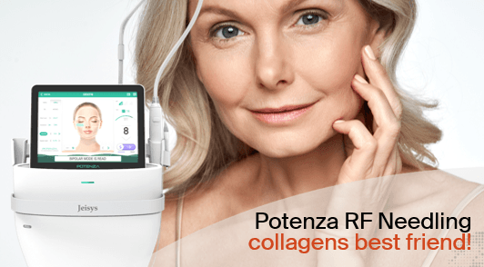 Potenza RF Needling – collagens best friend!