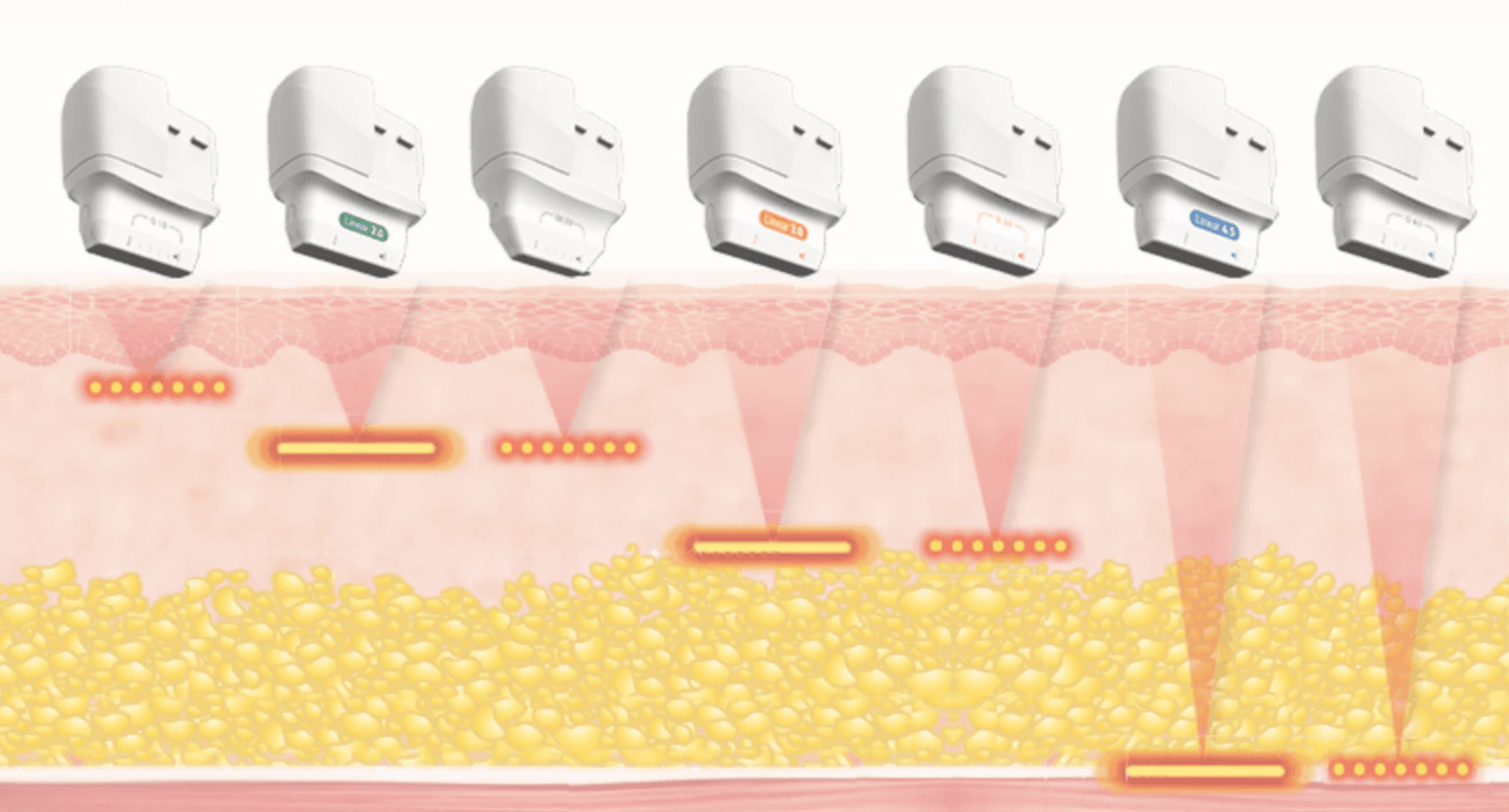 ultracel-q-core-technology