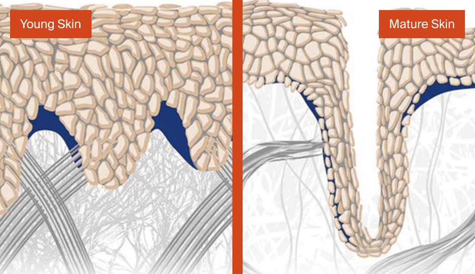 Skin Elasticity