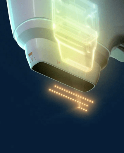 ultracel-q-core-technology