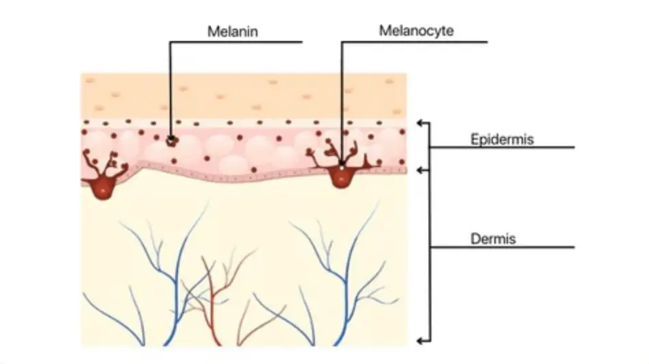 What is Skin Pigmentation?